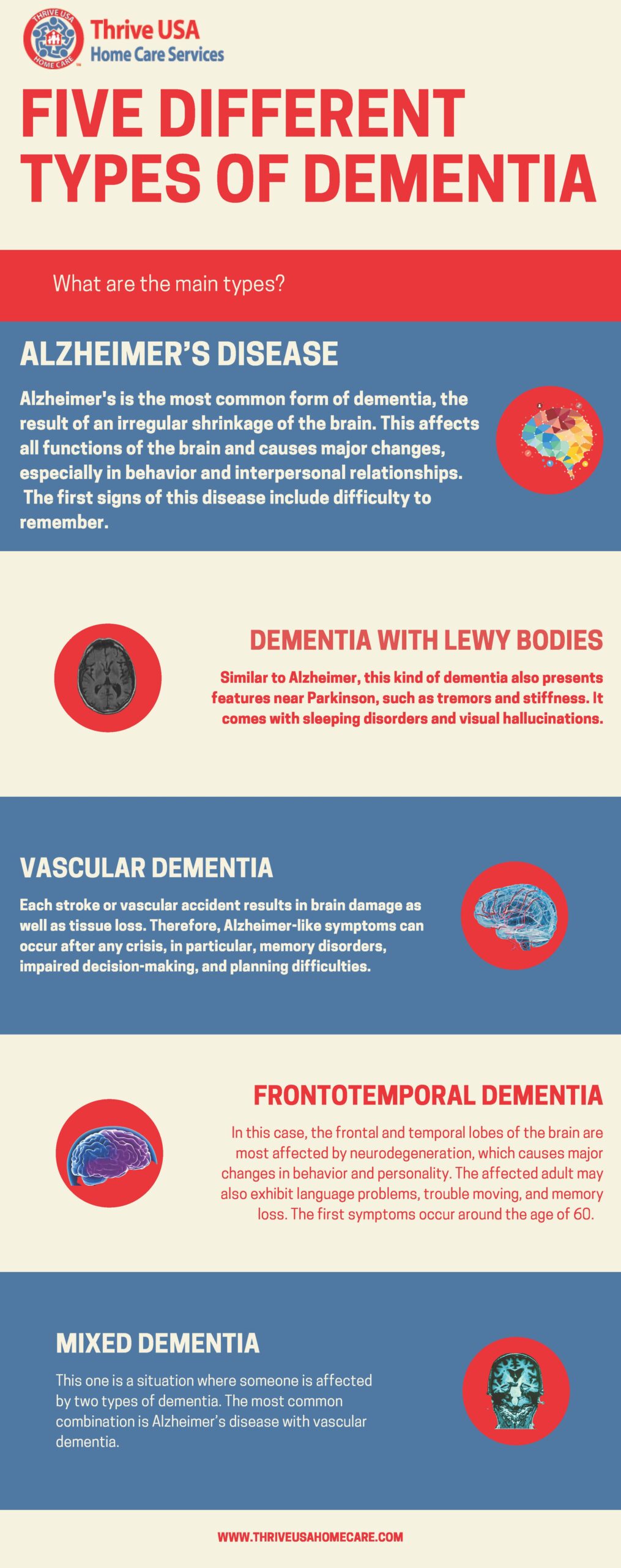 5 Different Types Of Dementia Thrive USA Home Care Thrive USA Home Care   Thrive USA 5 Types Dementia V2 3 Scaled 1 